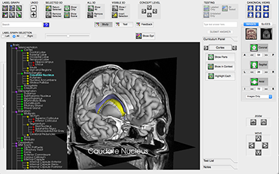 Software-SMtB-MRI